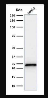 Western Blot: p21/CIP1/CDKN1A Antibody (SPM306) - Azide and BSA Free [NBP2-47782] - Analysis of human HeLa cell lysate using p21/CIP1/CDKN1A Antibody (SPM306).