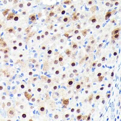 Immunohistochemistry-Paraffin: p27/Kip1 Antibody (9R5B4) [NBP3-15662] - Rat ovary using p27/Kip1 Rabbit mAb (NBP3-15662) at dilution of 1:100 (40x lens).Perform microwave antigen retrieval with 10 mM PBS buffer pH 7.2 before commencing with IHC staining protocol.