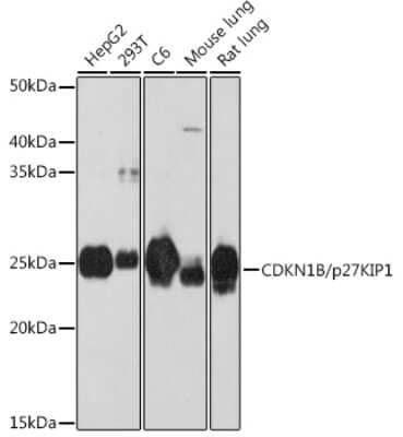 Western Blot: p27/Kip1 Antibody (9R5B4) [NBP3-15662] - Analysis of extracts of various cell lines, using p27/Kip1 antibody (NBP3-15662) at 1:1000 dilution. Secondary antibody: HRP Goat Anti-Rabbit IgG (H+L) at 1:10000 dilution. Lysates/proteins: 25ug per lane. Blocking buffer: 3% nonfat dry milk in TBST. Detection: ECL Enhanced Kit. Exposure time: 3min.