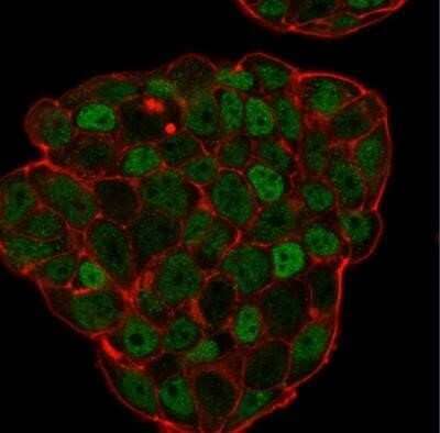 Immunocytochemistry/Immunofluorescence: p27/Kip1 Antibody (KIP1/769) - Azide and BSA Free [NBP2-47769] - Analysis of PFA-fixed MCF-7 cells labeling p27 with p27/Kip1 Antibody (KIP1/769) followed by Goat anti-Mouse IgG-CF488 (Green). Membrane is stained with Phalloidin-CF640.