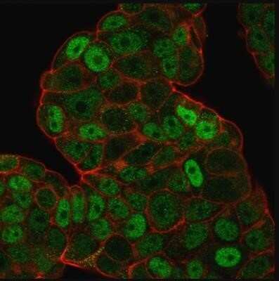 Immunocytochemistry/Immunofluorescence: p27/Kip1 Antibody (SPM348) - Azide and BSA Free [NBP2-34766] - Analysis of PFA-fixed MCF-7 cells labeling p27 with p27/Kip1 Antibody (SPM348) followed by goat anti-mouse IgG-CF488. Membrane is stained with Phalloidin-CF640.