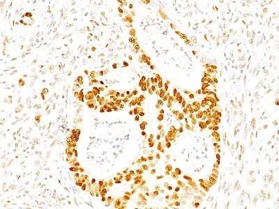 Immunohistochemistry-Paraffin: p27/Kip1 Antibody (SPM348) - Azide and BSA Free [NBP2-34766] - Human colon stained with p27 MAb (SPM348)
