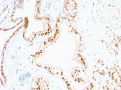 Immunohistochemistry-Paraffin: p27/Kip1 Antibody (SPM348) - IHC-Prediluted [NBP2-44494] - Human Prostate stained with p27/Kip1 Antibody (SPM348).