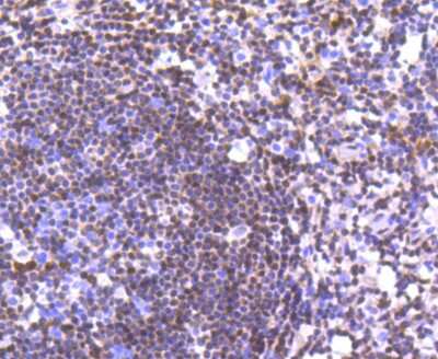 Immunohistochemistry-Paraffin: p27/Kip1 Antibody (SU37-04) [NBP2-67485] - Analysis of paraffin-embedded human tonsil tissue using anti-p27 KIP 1 antibody. Counter stained with hematoxylin.