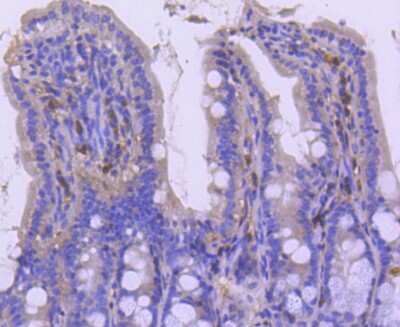 Immunohistochemistry-Paraffin: p27/Kip1 Antibody (SU37-04) [NBP2-67485] - Analysis of paraffin-embedded mouse colon tissue using anti-p27 KIP 1 antibody. Counter stained with hematoxylin.