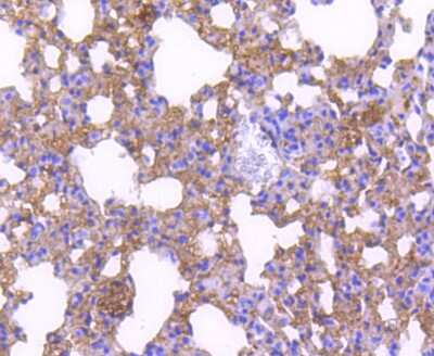 Immunohistochemistry-Paraffin: p27/Kip1 Antibody (SU37-04) [NBP2-67485] - Analysis of paraffin-embedded mouse lung tissue using anti-p27 KIP 1 antibody. Counter stained with hematoxylin.