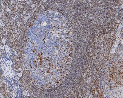 Immunohistochemistry-Paraffin: p27/Kip1 Antibody (SU37-04) [NBP2-67485] - Immunohistochemical analysis of paraffin-embedded human tonsil tissue using anti-p27/Kip1 antibody. The section was pre-treated using heat mediated antigen retrieval with sodium citrate buffer (pH 6.0) for 20 minutes. The tissues were blocked in 5% BSA for 30 minutes at room temperature, washed with ddH2O and PBS, and then probed with the primary antibody (ET1608-61, 1/200) for 30 minutes at room temperature. The detection was performed using an HRP conjugated compact polymer system. DAB was used as the chromogen. Tissues were counterstained with hematoxylin and mounted with DPX.