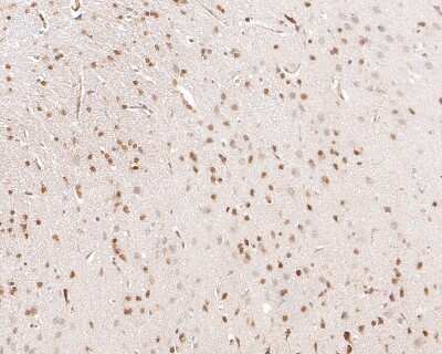 Immunohistochemistry-Paraffin: p27/Kip1 Antibody (SU37-04) [NBP2-67485] - Immunohistochemical analysis of paraffin-embedded rat brain tissue using anti-p27/Kip1 antibody. The section was pre-treated using heat mediated antigen retrieval with sodium citrate buffer (pH 6.0) for 20 minutes. The tissues were blocked in 5% BSA for 30 minutes at room temperature, washed with ddH2O and PBS, and then probed with the primary antibody (ET1608-61, 1/50) for 30 minutes at room temperature. The detection was performed using an HRP conjugated compact polymer system. DAB was used as the chromogen. Tissues were counterstained with hematoxylin and mounted with DPX.