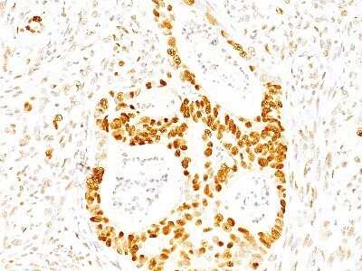 Immunohistochemistry-Paraffin: p27/Kip1 Antibody (SX53G8) - IHC-Prediluted [NBP2-44493] - Formalin-paraffin human colon stained with p27 MAb (SX53G8)