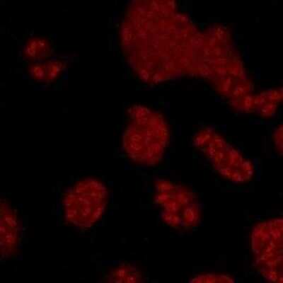 Immunocytochemistry/Immunofluorescence: p38 alpha Antibody (9-B9) [NBP2-67002] - Staining of MAPK14 in Hela cells (red). Cells were fixed in paraformaldehyde, permeabilised with 0.25% Triton X100/PBS.