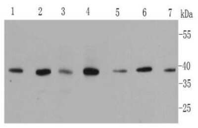 Western Blot: p38 alpha Antibody (9-B9) [NBP2-67002] - Analysis of MAPK14 on different cell lysates using anti-MAPK14 antibody at 1/500 dilution. Positive control: Lane 1: A431 Lane 2: HepG2 Lane 3: Hela Lane 4: NIH/3T3 Lane 5: Jurkat Lane 6: 293T Lane 7: mouse placenta