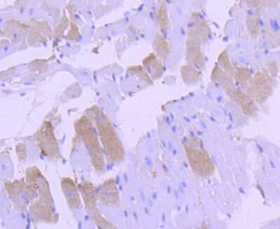 Immunohistochemistry-Paraffin: p38 alpha Antibody (JF55-07) [NBP2-67006] - Analysis of paraffin-embedded mouse heart tissue using anti-p38 MAPK antibody. Counter stained with hematoxylin.