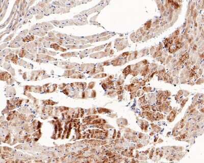 Immunohistochemistry-Paraffin: p38 alpha Antibody (JF55-07) [NBP2-67006] - Analysis of paraffin-embedded mouse heart tissue with Rabbit anti-p38 alpha antibody washed with ddH2O and PBS, and then probed with the primary antibody  at 1/200 dilution for 1 hour at room temperature. The detection was performed using an HRP conjugated compact polymer system. DAB was used as the chromogen. Tissues were counterstained with hematoxylin and mounted with DPX.