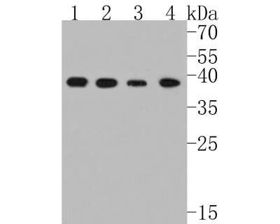 Western Blot: p38 alpha Antibody (JF55-07) [NBP2-67006] - Western blot analysis of p38 alpha on different lysates. Proteins were transferred to a PVDF membrane and blocked with 5% BSA in PBS for 1 hour at room temperature. The primary antibody (1/500) was used in 5% BSA at room temperature for 2 hours. Goat Anti-Rabbit IgG - HRP Secondary Antibody (HA1001) at 1:5,000 dilution was used for 1 hour at room temperature. Positive control: Lane 1: NIH/3T3 cell lysate Lane 2: THP-1 cell lysate Lane 3: SiHa cell lysate Lane 4: HL-60 cell lysate