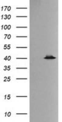 Western Blot: p38 delta/SAPK4 Antibody (OTI12B2) - Azide and BSA Free [NBP2-73188] - Analysis of HEK293T cells were transfected with the pCMV6-ENTRY control (Left lane) or pCMV6-ENTRY p38 delta/SAPK4.