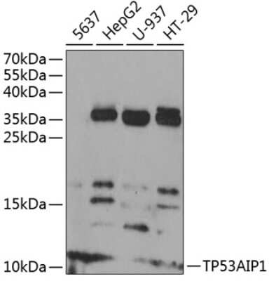 Western Blot: p53 AIP1 Antibody [NBP2-94841] - Analysis of extracts of various cell lines, using p53 AIP1 at 1:1000 dilution. Secondary antibody: HRP Goat Anti-Rabbit IgG (H+L) at 1:10000 dilution. Lysates/proteins: 25ug per lane. Blocking buffer: 3% nonfat dry milk in TBST. Detection: ECL Basic Kit . Exposure time: 90s.