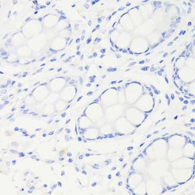 Immunohistochemistry-Paraffin: p53 Antibody (9L6E2) [NBP3-15792] - Immunohistochemistry of paraffin-embedded Human colon (negative control sample) using [KO Validated] p53 Rabbit mAb (NBP3-15792) at dilution of 1:100 (40x lens).Perform high pressure antigen retrieval with 10 mM citrate buffer pH 6.0 before commencing with IHC staining protocol.