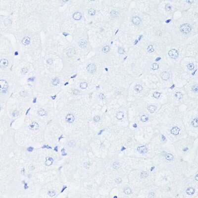 Immunohistochemistry-Paraffin: p53 Antibody (9L6E2) [NBP3-15792] - Immunohistochemistry of paraffin-embedded Human liver (negative control sample) using [KO Validated] p53 Rabbit mAb (NBP3-15792) at dilution of 1:100 (40x lens).Perform high pressure antigen retrieval with 10 mM citrate buffer pH 6.0 before commencing with IHC staining protocol.