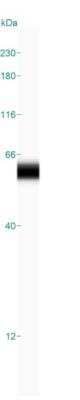 Simple Western: p53 Antibody (DO-7) [NBP2-34308] - Simple Western lane view shows a specific band for p53 in 0.2 mg/ml of MDA-MB-231 lysate. This experiment was performed under reducing conditions using the 12-230 kDa separation system.