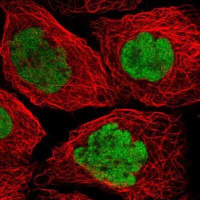 <b>Orthogonal Strategies Validation. </b>Immunocytochemistry/Immunofluorescence: p53 Antibody [NBP2-56234] - Staining of human cell line A-431 shows localization to nucleoplasm. Antibody staining is shown in green.