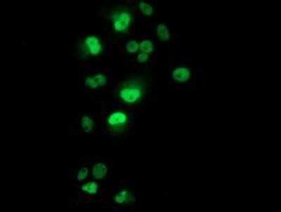 Immunocytochemistry/Immunofluorescence: p53 Antibody (OTI5E2) - Azide and BSA Free [NBP2-73200] - Staining of COS7 cells transiently transfected by pCMV6-ENTRY p53.