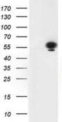 Western Blot: p53 Antibody (OTI5E2) - Azide and BSA Free [NBP2-73200] - HEK293T cells were transfected with the pCMV6-ENTRY control (Left lane) or pCMV6-ENTRY p53 (Right lane) cDNA for 48 hrs and lysed. Equivalent amounts of cell lysates (5 ug per lane) were separated by SDS-PAGE and immunoblotted with anti-p53.