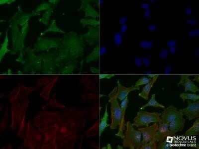 Immunocytochemistry/Immunofluorescence: p53 Antibody (PAb 240) - Azide and BSA Free [NBP2-80898] - HeLa cells were fixed for 10 minutes using 10% formalin and then permeabilized for 5 minutes using 1X TBS + 0.5% Triton X-100. The cells were incubated with anti-p53 (PAb 240) [NB200-103] at a 1:200 dilution overnight at 4C and detected with an anti-mouse DyLight 488 (Green) at a 1:500 dilution. Actin was detected with Phalloidin 568 (Red) at a 1:200 dilution. Nuclei were counterstained with DAPI (Blue). Cells were imaged using a 40X objective. Image from the standard format of this antibody.