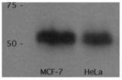 Western Blot: p53 Antibody (PAb 240) - Azide and BSA Free [NBP2-80898] - Analysis of p53 in MCF7 and HeLa lystates. Image courtesy of anonymous customer product review. Image from the standard format of this antibody.