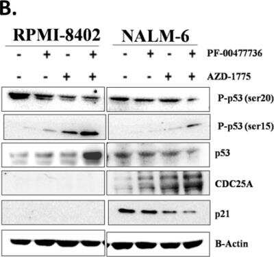 Western Blot: p53 Antibody (Pab DO-1) [NBP2-50538] - B) Western Blot analyses of RPMI-8402 and NALM-6 cell lines treated for 24 h with AZD-1775 (185 nM) and PF-00477736 (25 and 250 nM respectively). B-actin was used for loading normalization. For relative quantification of each protein see Figure S3A and for whole western blot images see Figure S6. Image collected and cropped by CiteAb from the following publication (//www.mdpi.com/2072-6694/11/11/1654) licensed under a CC-BY license.