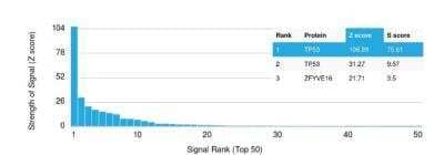 Protein Array: p53 Antibody (TP53/1799R) [NBP2-59631] - containing more than 19,000 full-length human proteins. Z- and S- Score: The Z-score represents the strength of a signal that an antibody (in combination with a fluorescently-tagged anti-IgG secondary) produces when binding to a particular protein on the HuProt array. Z-scores are described in units of standard deviations above the mean value of all signals generated on that array. If targets on HuProt are arranged in descending order of the Z-score, the S-score is the difference between the Z-score. S-score therefore represents the relative target specificity of an Ab to its intended target. An Ab is considered to specific to its intended target, if the Ab has an S-score of at least 2.5. For example, if Ab binds to protein X with a Z-score of 43 and to protein Y with a Z-score of 14, then the S-score for the binding of that Ab to protein X is equal to 29