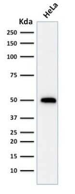 Western Blot: p53 Antibody (TRP/816) [NBP2-59626] - Western Blot Analysis of human HeLa cell lysate using p53 Antibody (TRP/816).