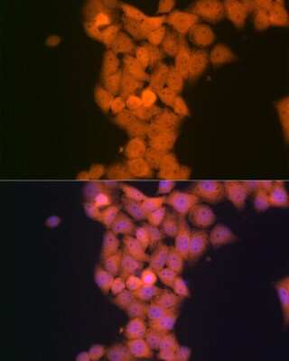 Immunocytochemistry/Immunofluorescence: p53 DINP1 Antibody (9Y6Z7) [NBP3-16620] - Immunofluorescence analysis of HeLa cells using p53 DINP1 Rabbit mAb (NBP3-16620) at dilution of 1:100 (40x lens). Blue: DAPI for nuclear staining.