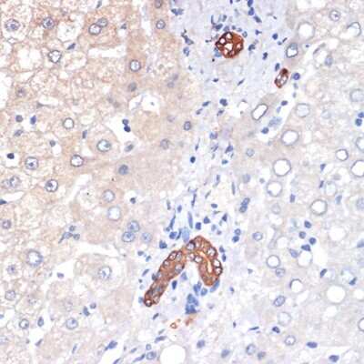 Immunohistochemistry-Paraffin: p53 DINP1 Antibody (9Y6Z7) [NBP3-16620] - Immunohistochemistry of paraffin-embedded human liver using p53 DINP1 Rabbit mAb (NBP3-16620) at dilution of 1:100 (40x lens).Perform microwave antigen retrieval with 10 mM Tris/EDTA buffer pH 9.0 before commencing with IHC staining protocol.