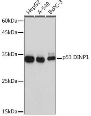 Western Blot: p53 DINP1 Antibody (9Y6Z7) [NBP3-16620] - Western blot analysis of extracts of various cell lines, using p53 DINP1 Rabbit mAb (NBP3-16620) at 1:1000 dilution. Secondary antibody: HRP Goat Anti-Rabbit IgG (H+L) at 1:10000 dilution. Lysates/proteins: 25ug per lane. Blocking buffer: 3% nonfat dry milk in TBST. Detection: ECL Basic Kit. Exposure time: 1s.