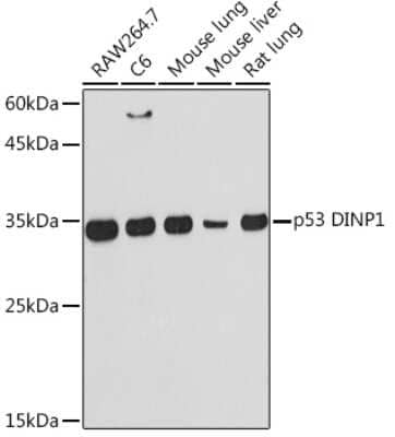 Western Blot: p53 DINP1 Antibody (9Y6Z7) [NBP3-16620] - Western blot analysis of extracts of various cell lines, using p53 DINP1 Rabbit mAb (NBP3-16620) at 1:1000 dilution. Secondary antibody: HRP Goat Anti-Rabbit IgG (H+L) at 1:10000 dilution. Lysates/proteins: 25ug per lane. Blocking buffer: 3% nonfat dry milk in TBST. Detection: ECL Basic Kit. Exposure time: 60s.