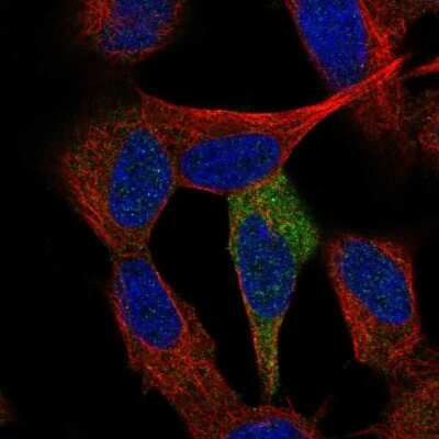 Immunocytochemistry/Immunofluorescence: p53 DINP1 Antibody [NBP1-85108] - Immunofluorescent staining of human cell line SH-SY5Y shows localization to cytosol.