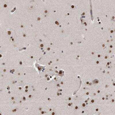 Immunohistochemistry-Paraffin: p53 DINP1 Antibody [NBP1-85108] - Staining of human cerebral cortex shows nuclear positivity in both neuronal and glial cells.