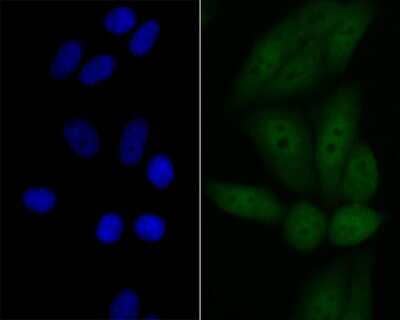 Immunocytochemistry/Immunofluorescence: p53 DINP1 Antibody (JG37-64) [NBP2-76860] - ICC staining p53DINP1 in HepG2 cells (green). The nuclear counter stain is DAPI (blue). Cells were fixed in paraformaldehyde, permeabilised with 0.25% Triton X100/PBS.