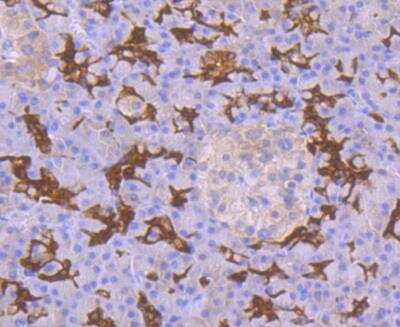 Immunohistochemistry: p53 DINP1 Antibody (JG37-64) [NBP2-76860] - Immunohistochemical analysis of paraffin-embedded human pancreas tissue using anti-p53DINP1 antibody. Counter stained with hematoxylin.