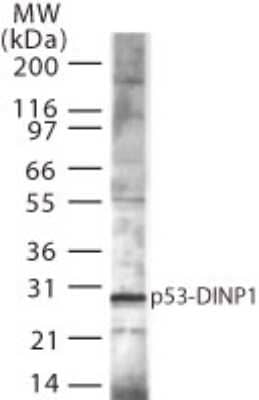 Western Blot: p53 DINP1 Antibody [NB100-56627] - analysis of p53DINP1 expression in mouse spleen using this antibody.