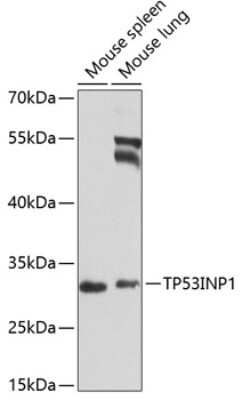 Western Blot: p53 DINP1 Antibody [NBP2-93698] - Analysis of extracts of various cell lines, using p53 DINP1 at 1:1000 dilution. Secondary antibody: HRP Goat Anti-Rabbit IgG (H+L) at 1:10000 dilution. Lysates/proteins: 25ug per lane. Blocking buffer: 3% nonfat dry milk in TBST.