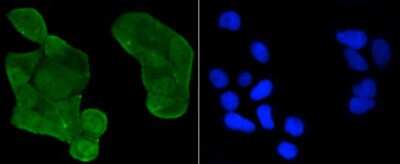 Immunocytochemistry/Immunofluorescence: p53 [ac Lys370] Antibody (SR40-09) [NBP2-67340] - Staining p53(acetyl K370) in Hela cells (green). The nuclear counter stain is DAPI (blue). Cells were fixed in paraformaldehyde, permeabilised with 0.25% Triton X100/PBS.