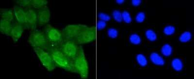 Immunocytochemistry/Immunofluorescence: p53 [ac Lys370] Antibody (SR40-09) [NBP2-67340] - Staining p53(acetyl K370) in HepG2 cells (green). The nuclear counter stain is DAPI (blue). Cells were fixed in paraformaldehyde, permeabilised with 0.25% Triton X100/PBS.