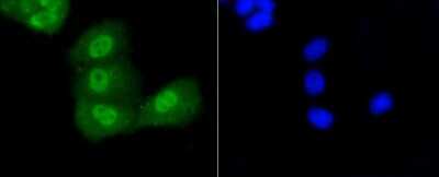 Immunocytochemistry/Immunofluorescence: p53 [ac Lys370] Antibody (SR40-09) [NBP2-67340] - Staining p53(acetyl K370) in PANC-1 cells (green). Cells were fixed in paraformaldehyde, permeabilised with 0.25% Triton X100/PBS.