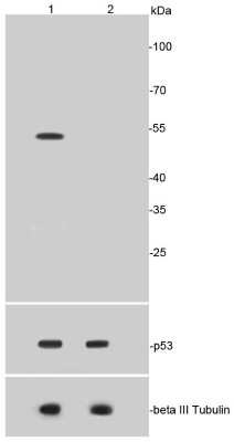 Western Blot: p53 [ac Lys370] Antibody (SR40-09) [NBP2-67340] - Analysis of p53(acetyl K370) on HepG2 cell lysates using anti-p53(acetyl K370) antibody at 1/1,000 dilution. Positive control: Lane 1: HepG2 treated with EPE 20uM and Trichostatin A 500 nM for 6 hours whole cell lysates Lane 3: HepG2 untreated whole