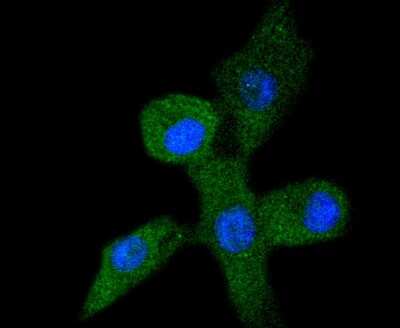 Immunocytochemistry/Immunofluorescence: p53 [ac Lys382] Antibody (SD0801) [NBP2-67804] - Staining p53 (acetyl K382) in A549 cells (green). The nuclear counter stain is DAPI (blue). Cells were fixed in paraformaldehyde, permeabilised with 0.25% Triton X100/PBS.