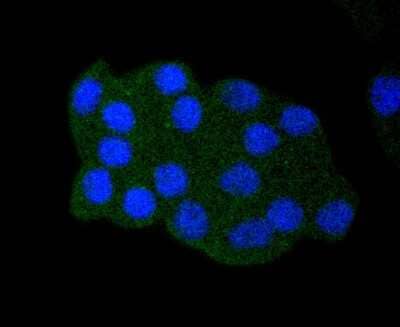 Immunocytochemistry/Immunofluorescence: p53 [ac Lys382] Antibody (SD0801) [NBP2-67804] - Staining p53 (acetyl K382) in HepG2 cells (green). The nuclear counter stain is DAPI (blue). Cells were fixed in paraformaldehyde, permeabilised with 0.25% Triton X100/PBS.