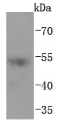 Western Blot: p53 [ac Lys382] Antibody (SD0801) [NBP2-67804] - Analysis of p53 (acetyl K382) on human skin lysates using anti-p53 (acetyl K382) antibody at 1/1,000 dilution.