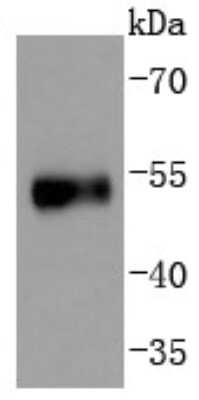 Western Blot: p53 [p Ser376] Antibody (SC57-07) [NBP2-67494] - Analysis of Phospho-p53(S376) on human skin lysates using anti-Phospho-p53(S376) antibody at 1/1,000 dilution.