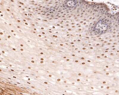 Immunohistochemistry-Paraffin: p53 [p Thr55] Antibody (SC58-01) [NBP2-67493] - Analysis of paraffin-embedded human esophagus tissue using anti-p53 [p Thr55] antibody. The section was pre-treated using heat mediated antigen retrieval with sodium citrate buffer (pH 6.0) for 20 minutes. The tissues were blocked in 1% BSA for 30 minutes at room temperature, washed with ddH2O and PBS, and then probed with the primary antibody (1/400) for 30 minutes at room temperature. The detection was performed using an HRP conjugated compact polymer system. DAB was used as the chromogen. Tissues were counterstained with hematoxylin and mounted with DPX.